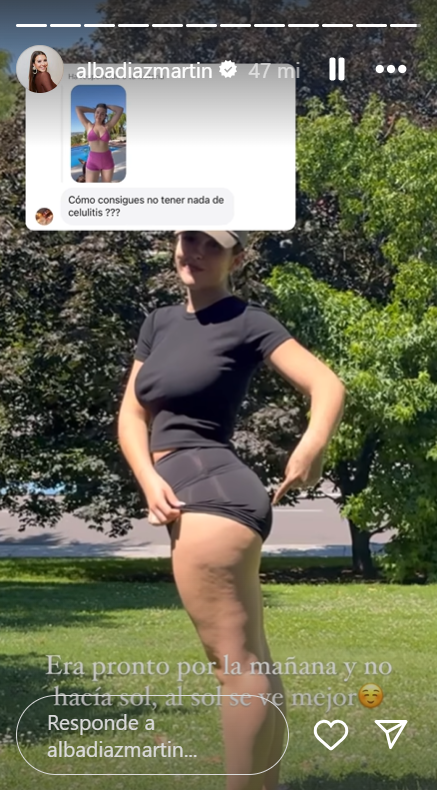 Alba Díaz muestra su celulitis